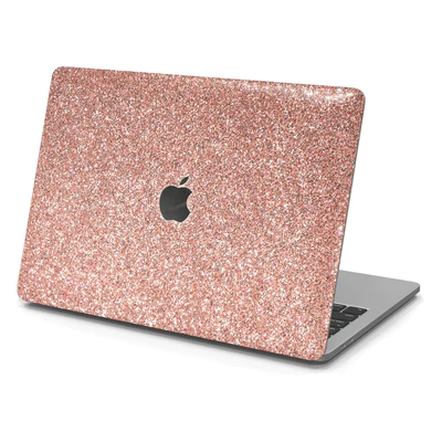 custom macbook case