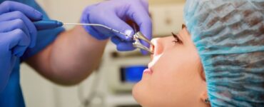 A Guide to the Average Cost of Balloon Sinuplasty Surgery