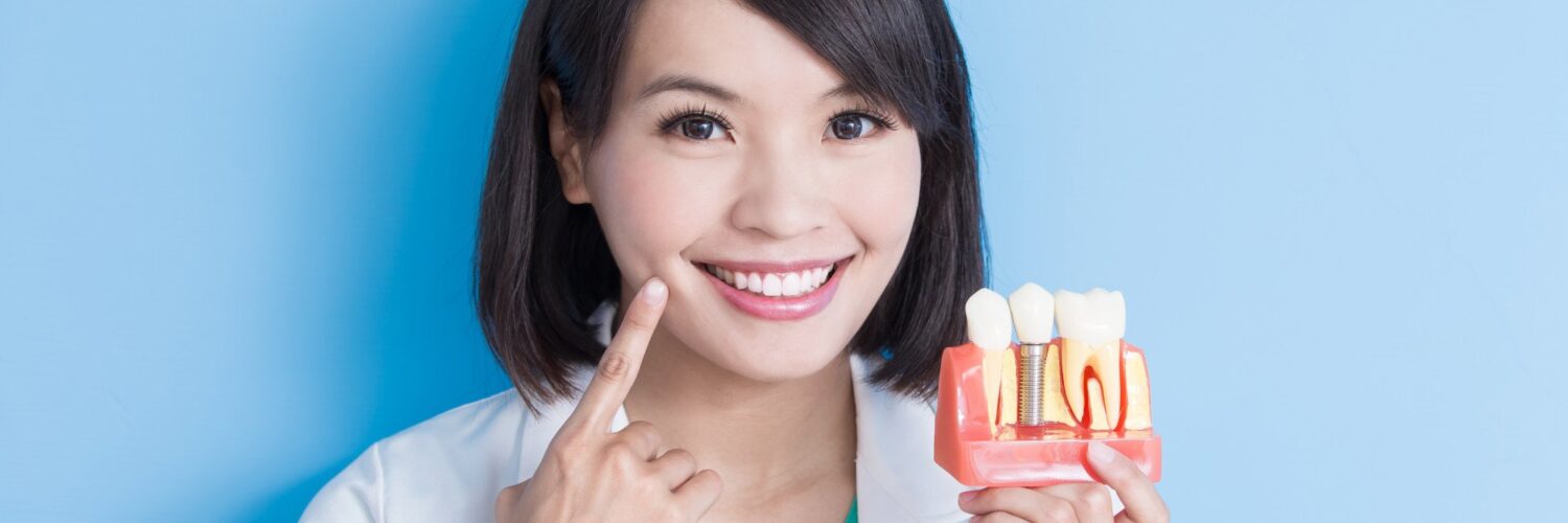alternatives to dental implants