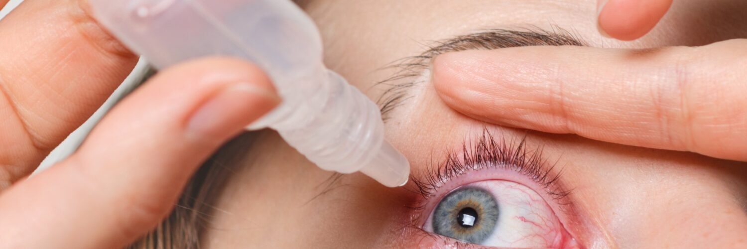 eye drops for droopy eyelids