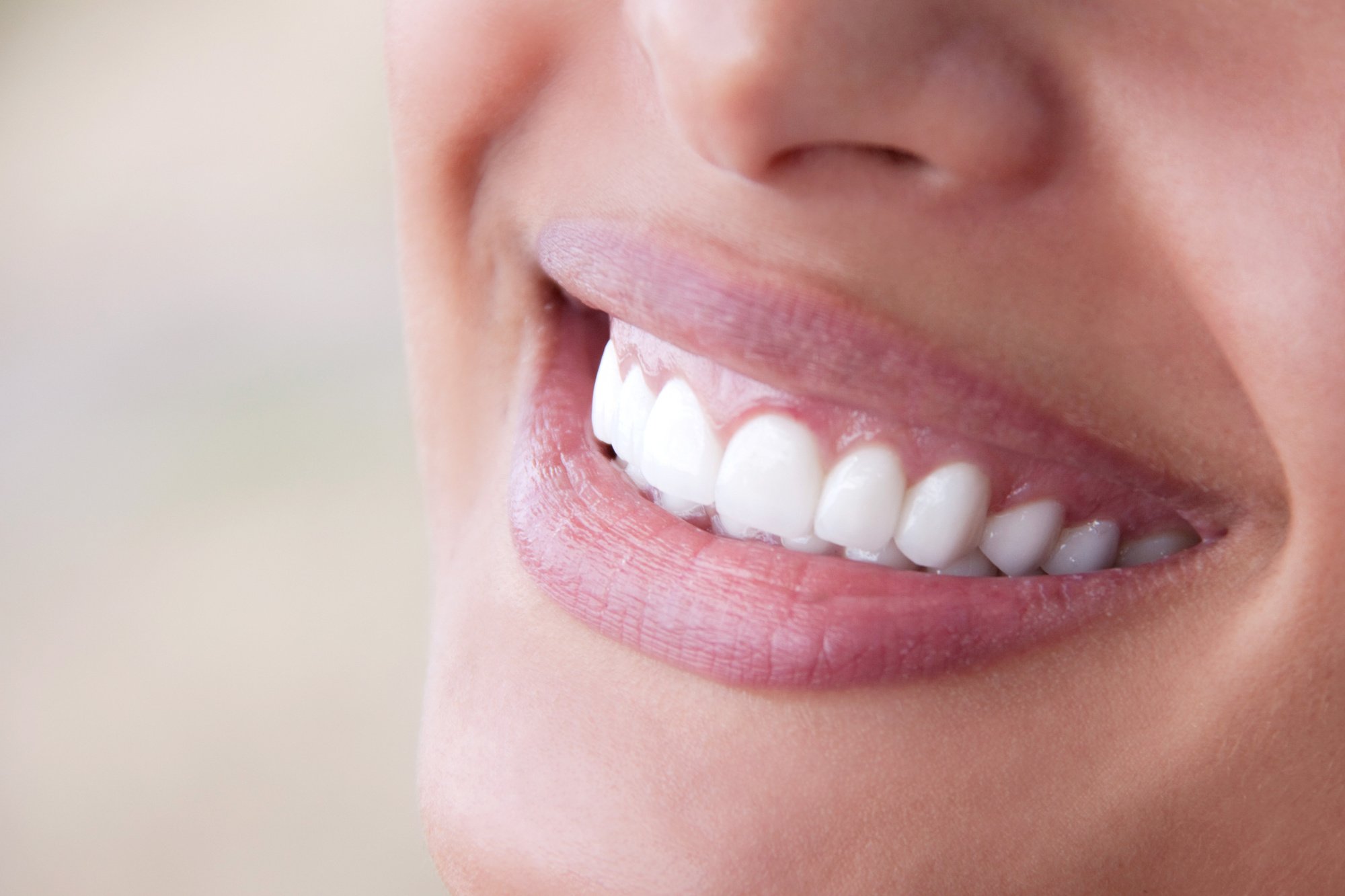 Teeth Bonding vs Veneers Understanding the Differences and Benefits