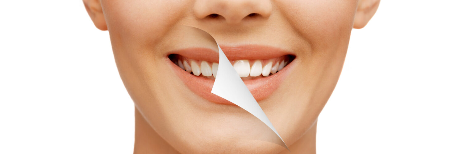 a better smile
