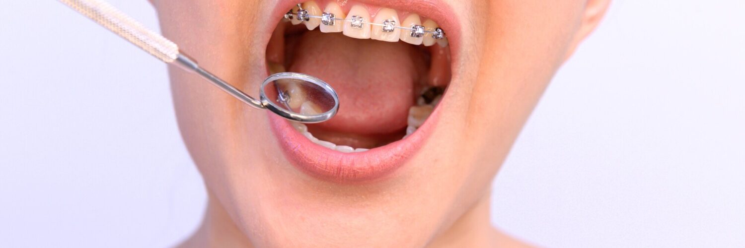 best orthodontist near me