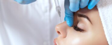 rhinoplasty before and after