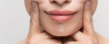 botox for a gummy smile