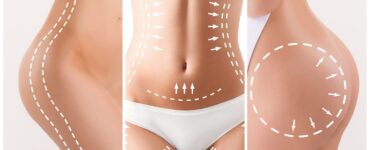 mommy makeover packages