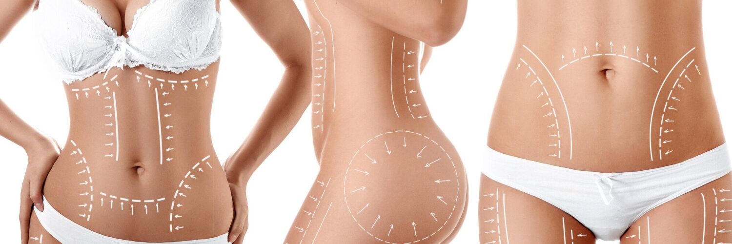 plastic surgery before and after