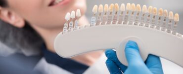 teeth prepped for veneers