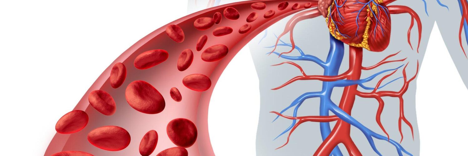 angioplasty cost