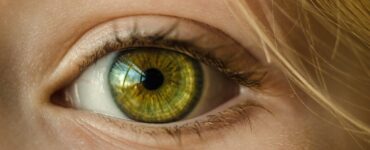 astigmatism and myopia