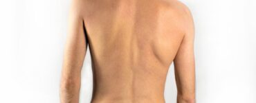 spinal misalignment symptoms