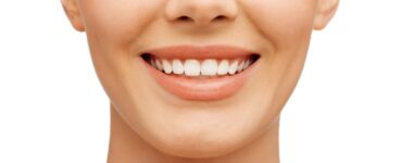 teeth reshaping