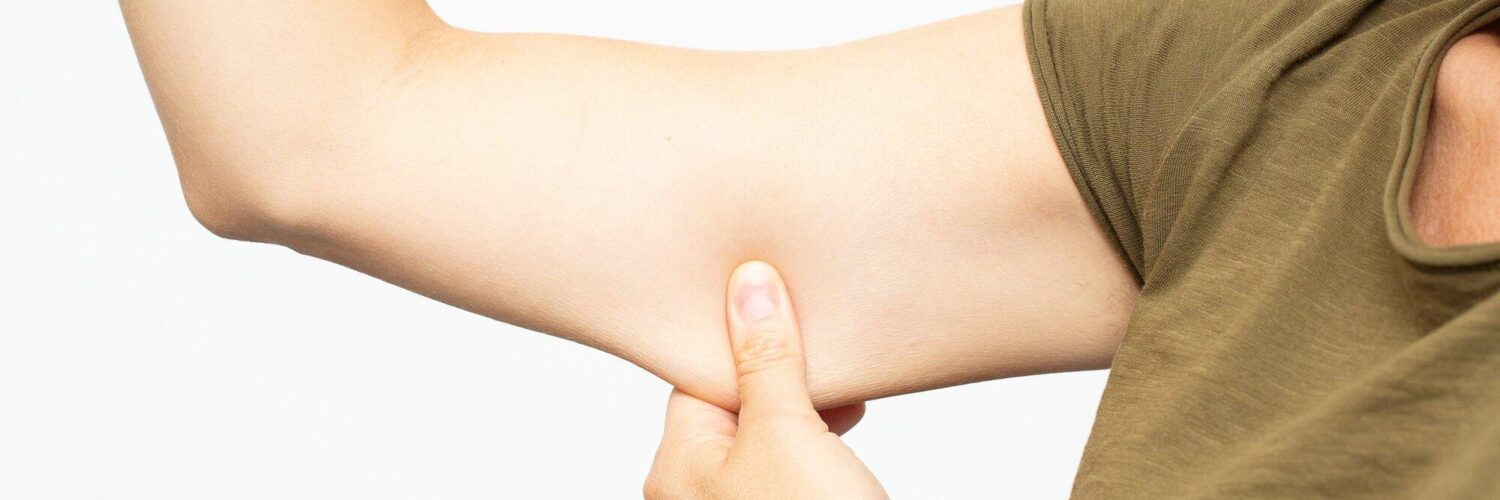 arm liposuction