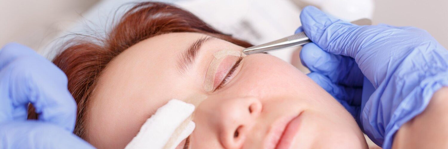 before and after eyelid surgery