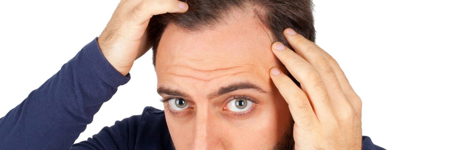 follicular unit extraction scarring