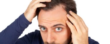 follicular unit extraction scarring