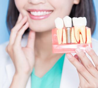 how long do dental implants last