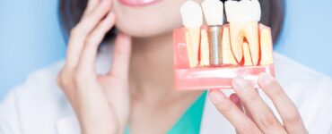 how long do dental implants last