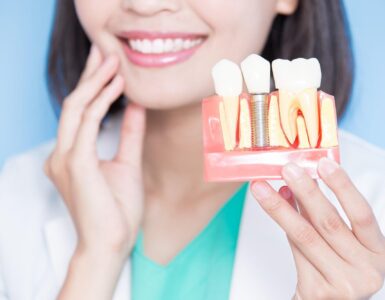 how long do dental implants last