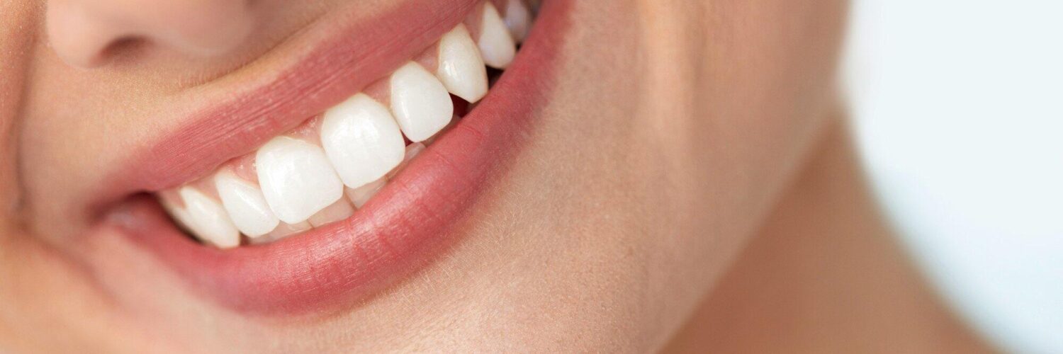 smile aesthetic