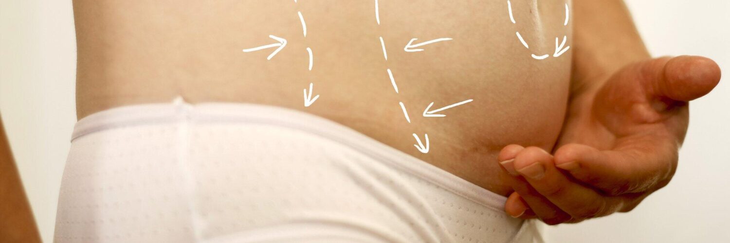 tummy tuck with liposuction