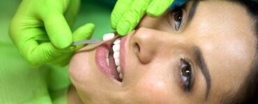 types of veneers and cost